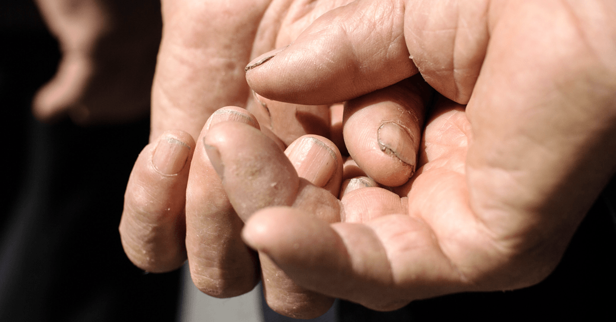 The best hand cream for working hands.